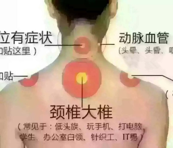 颈肩宝 (4).jpg