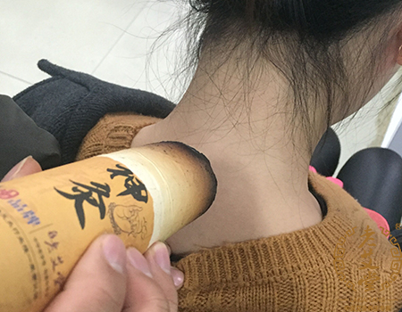 艾灸 大椎穴.jpg